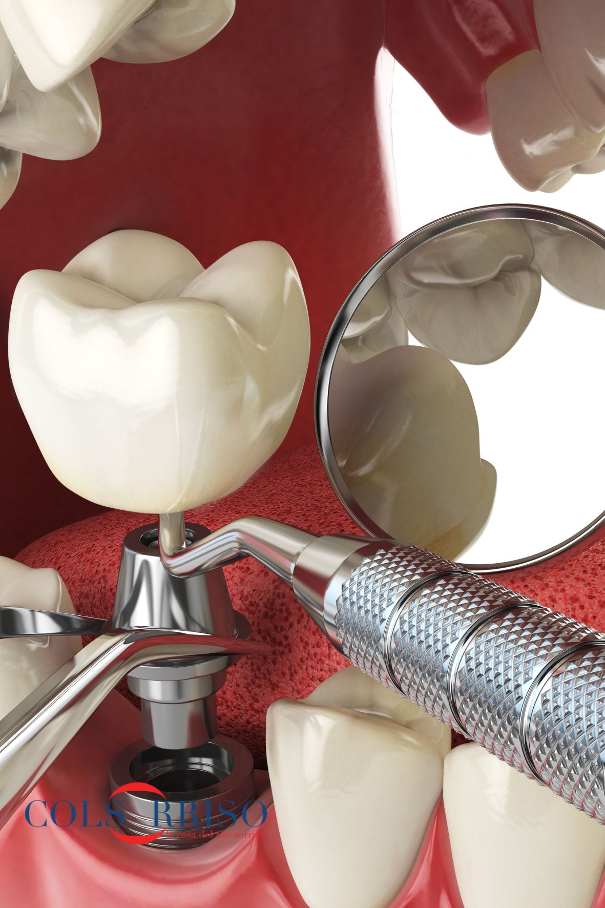 studi dentistici seregno muggiò monza